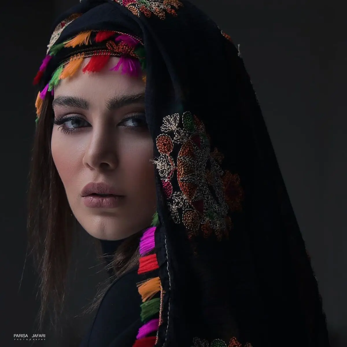 بیماری سحر قریشی افشا شد | چشم تتو شده سحر قریشی عفونت کرد!!+ عکس