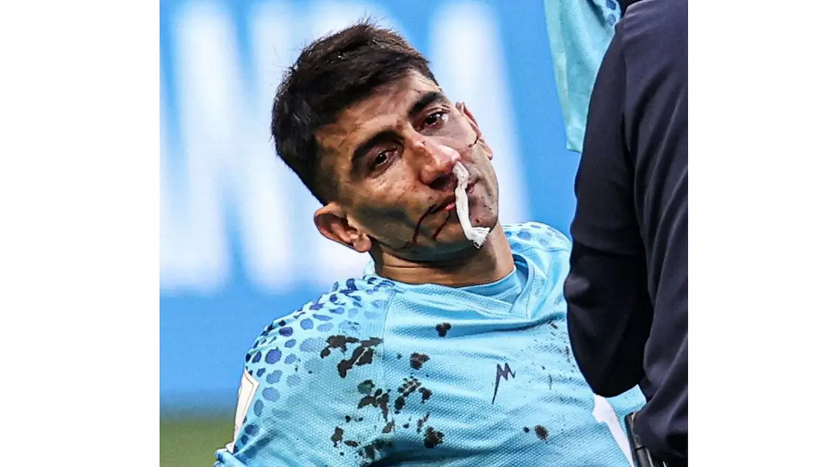 اوضاع خیط علیرضا بیرانوند نگران کننده شد 
