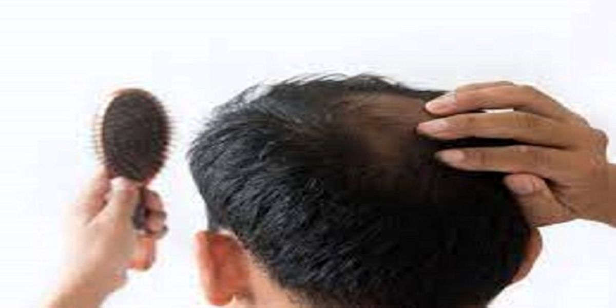 فوری: ریزش مو نشانه چه بیماری جدی است؟