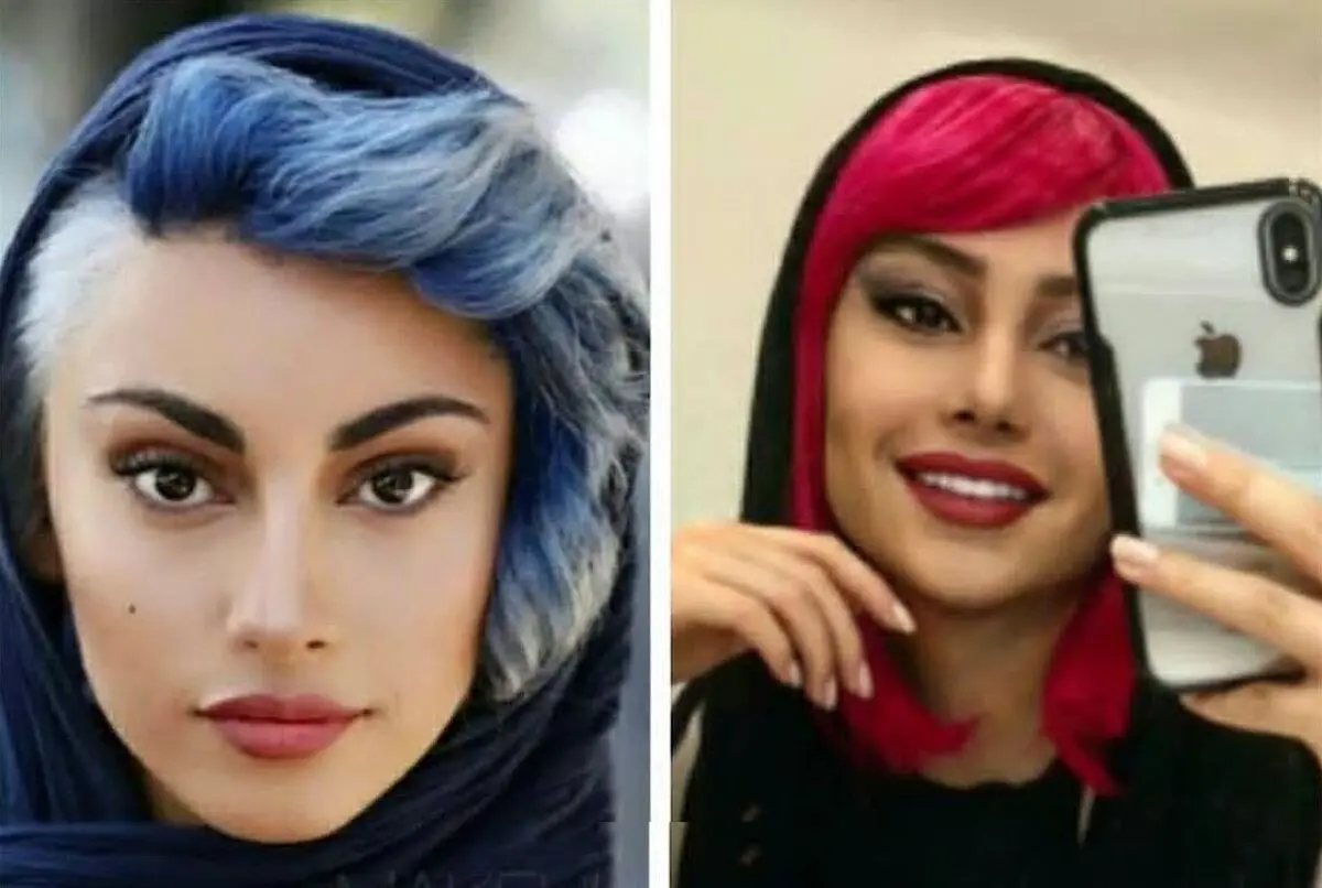 چه بلایی بر سر ترلان پروانه آمده؟ | خانم با این همه عمل رو صورتش شده یه آدم دیگه
