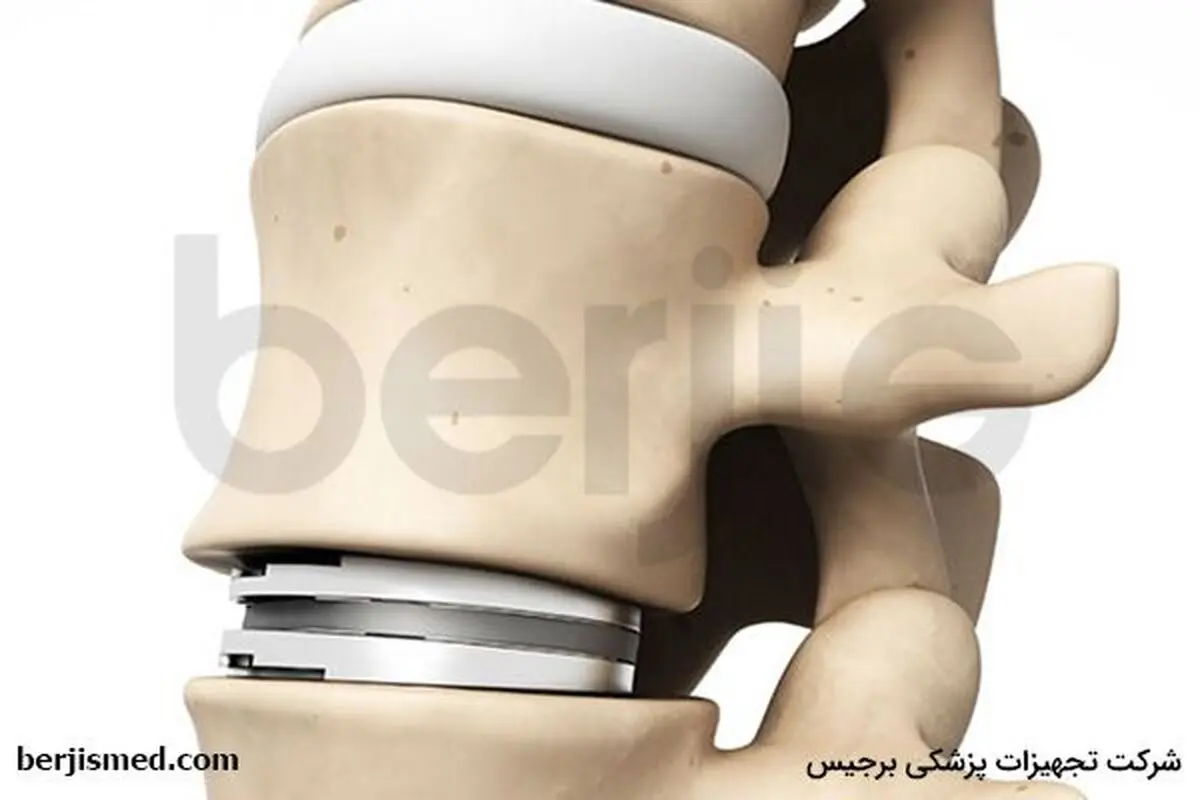 چگونه کم تهاجمی پارگی دیسک کمر را درمان کنیم؟