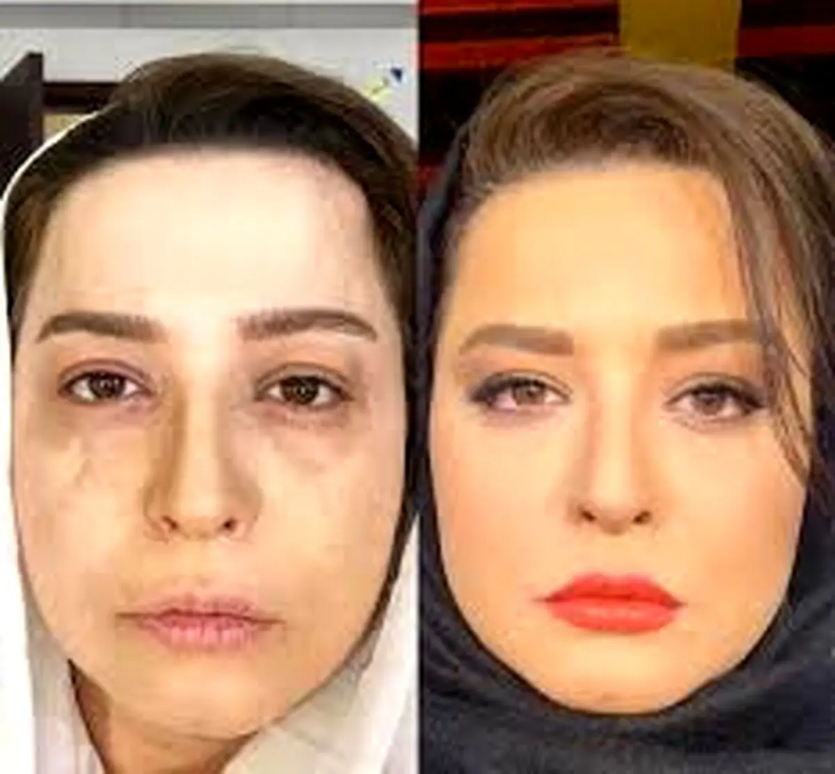 مهراوه شریفی نیا راهی بیمارستان شد 