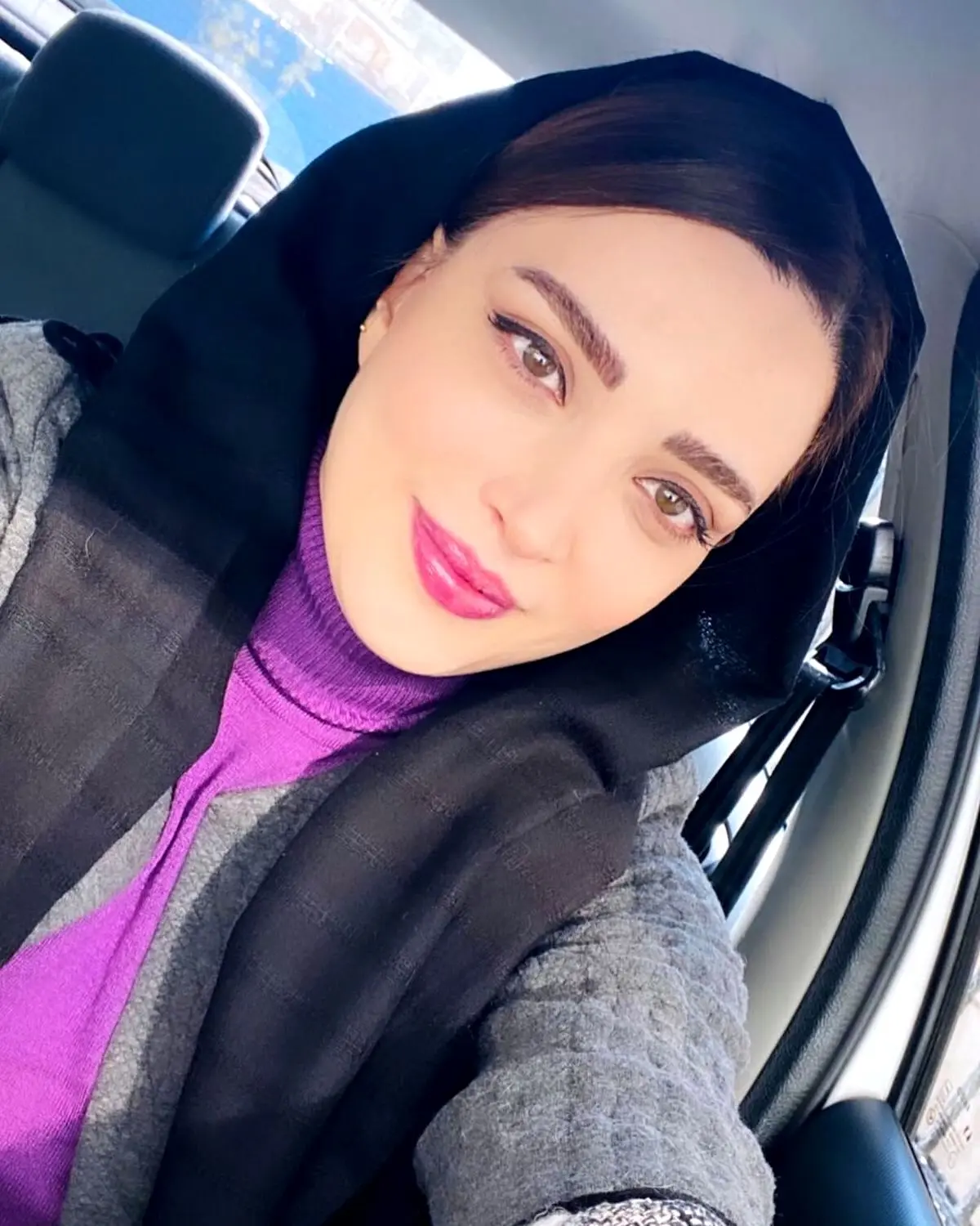 بهنوش طباطبایی با عمل جدید صورتش چه پزی میده | خانوم بازیگر روز به روز خوشگلتر از دیروز