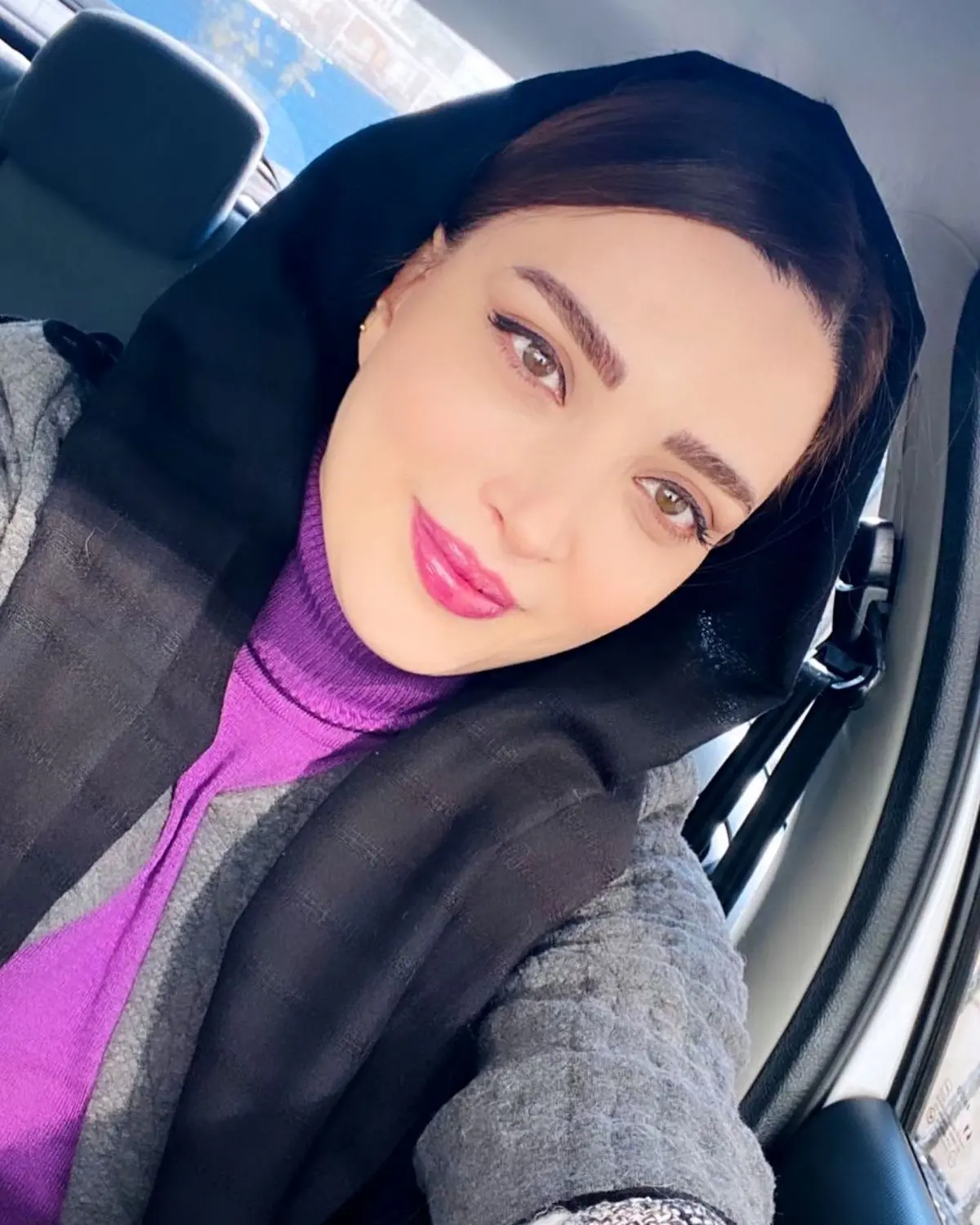 بهنوش طباطبایی با عمل جدید صورتش چه پزی میده | خانوم بازیگر روز به روز خوشگلتر از دیروز