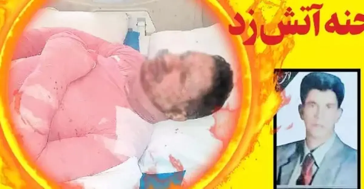 زن بیرحم شوهرش را آتش زده و فرار کرد | ببینید زن چه بلایی سر همسرش آورد!