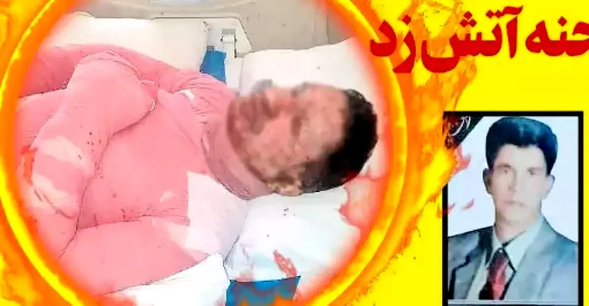 زن بیرحم شوهرش را آتش زده و فرار کرد | ببینید زن چه بلایی سر همسرش آورد!