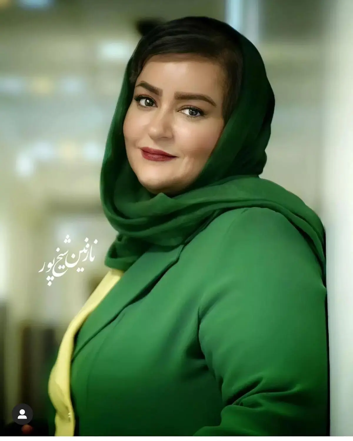 نعیمه نظام دوست هر روز خوشگلتر از دیروز | نعیمه نظام دوست عمل جراحی کرده؟