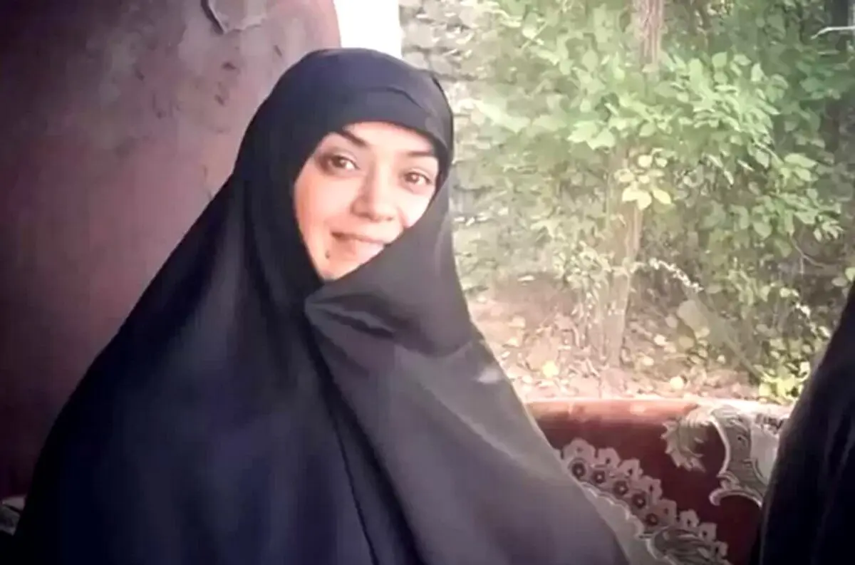 رونمایی الهام چرخنده از چهره عملی جدید خود | خانوم چرخنده هم تو کار عمل زیبایی رفت!