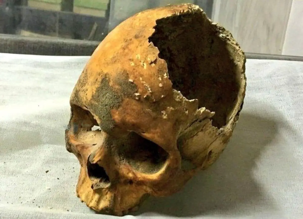 عکس جمجمه نادرشاه افشار همه را به وحشت انداخت 