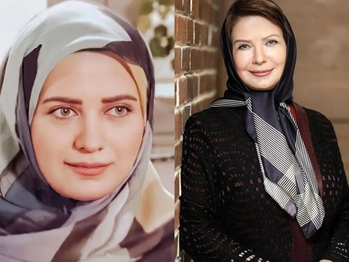 لعیا زنگنه چه بلایی سر خودش آورده؟ | لعیا زنگنه از صورت پر از پروتزش واسه سال جدید رونمایی کرد 