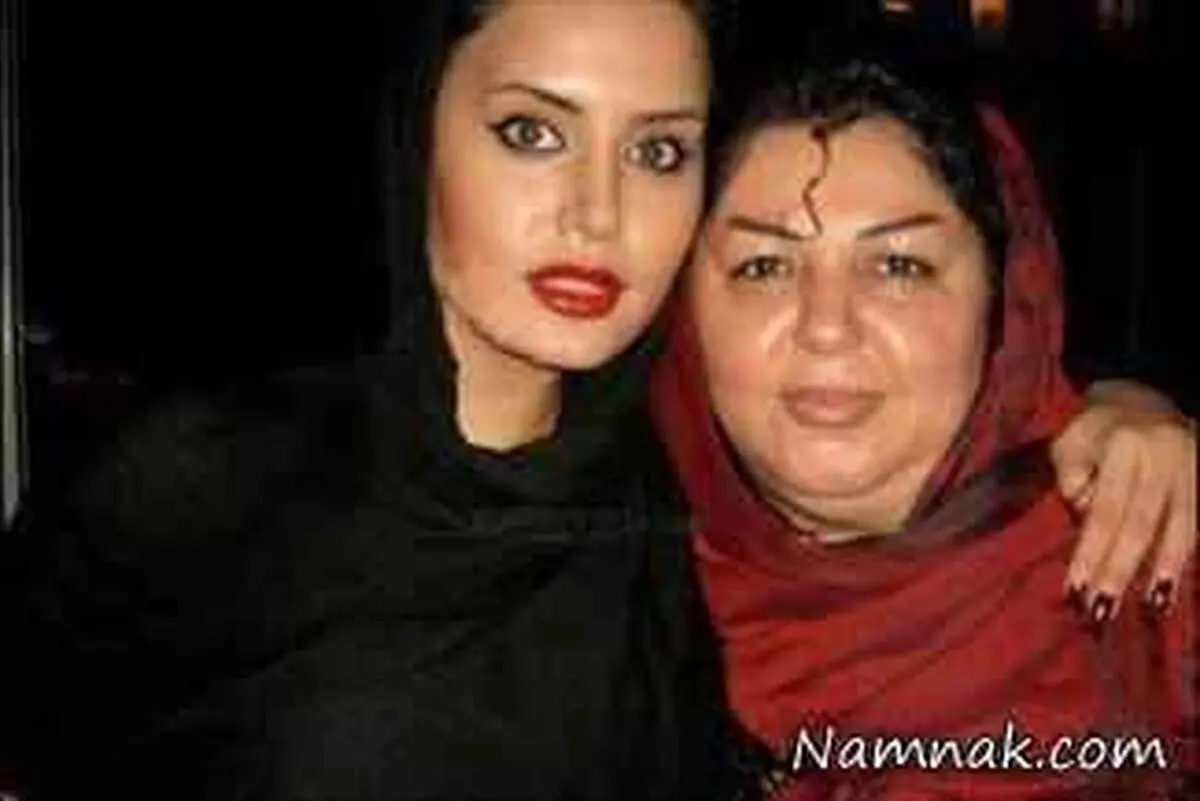تصادف وحشتناک الناز شاکردوست در کرج | الناز شاکردوست به کما رفت