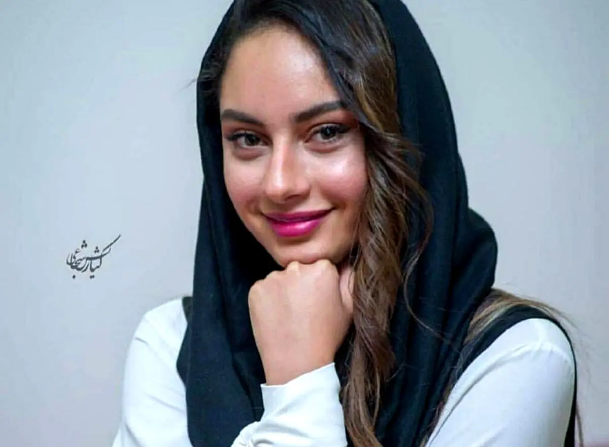قیافه عجیب ترلان پروانه بعد از عمل زیبایی | خانم کوبید از نو ساخت