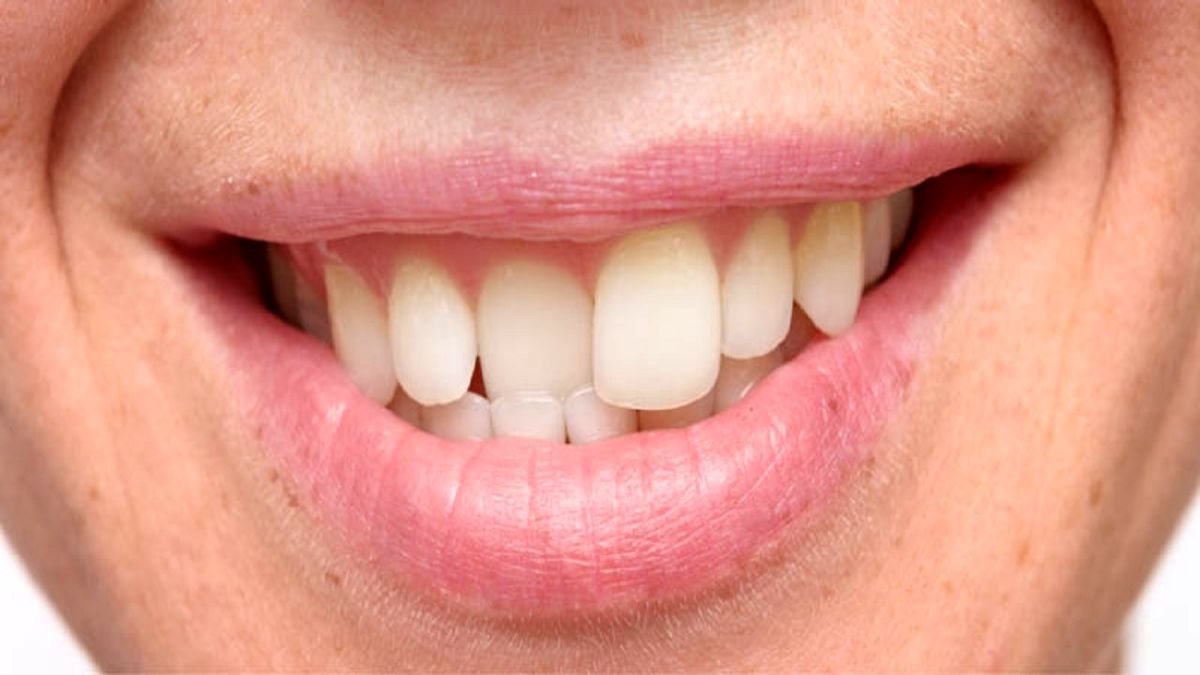 هشدار: عوارض خطرناک فشردگی دندان