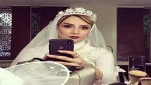 رونمایی شبنم قلی خانی از چهره بعد از عملش 